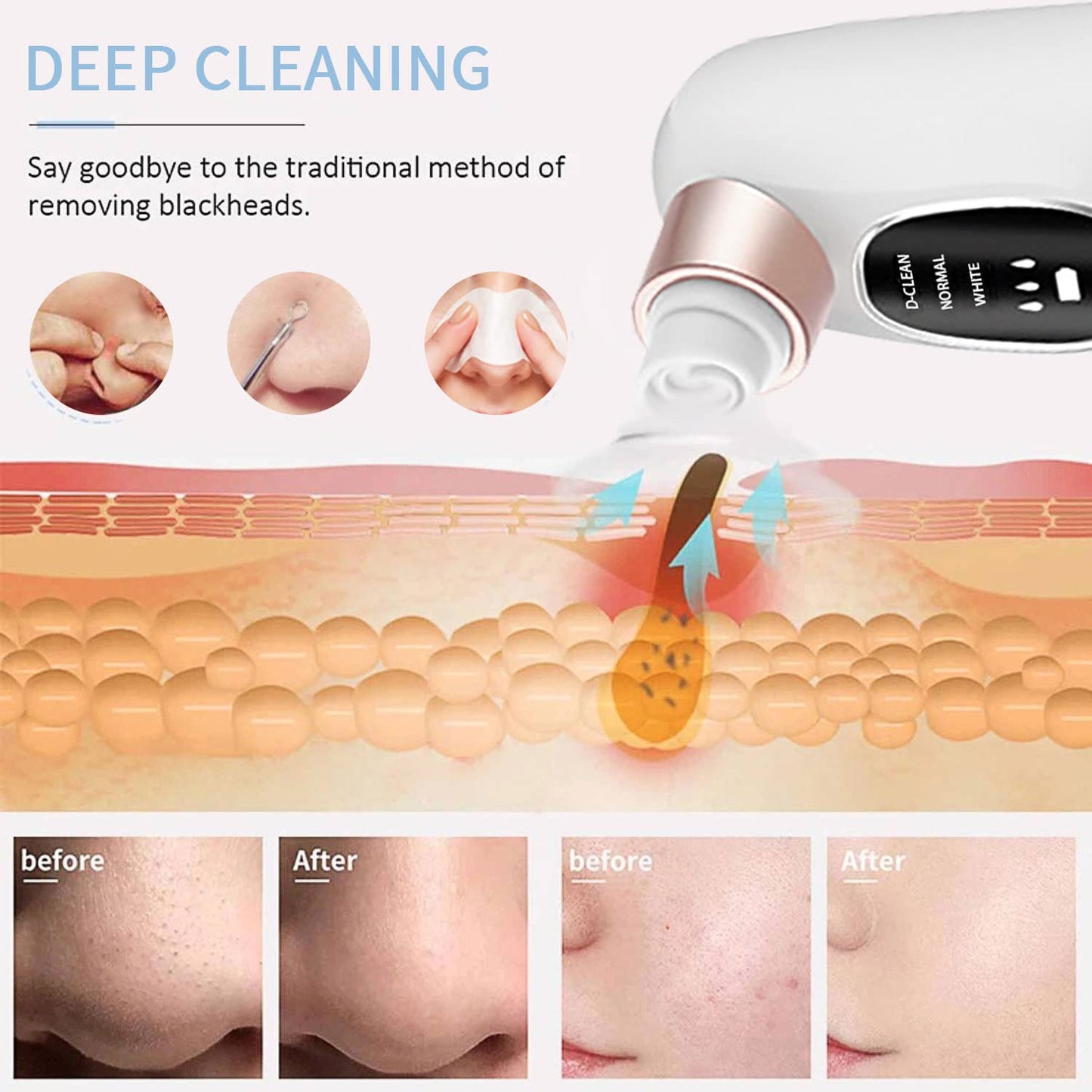 Aqua Vacuum Pore Cleaner | Mini Hydra Facial Device
