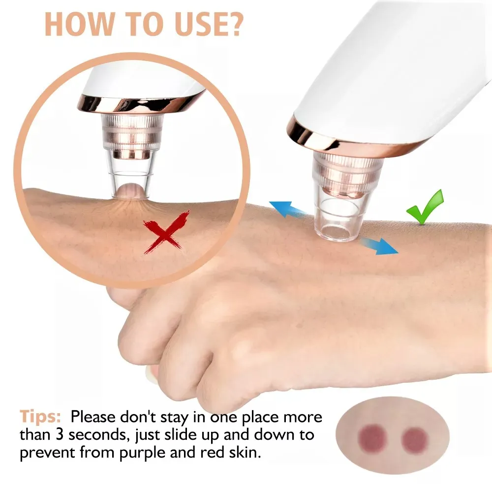 Original Multifunction Blackhead Removal Rechargeable Machine - Image 3