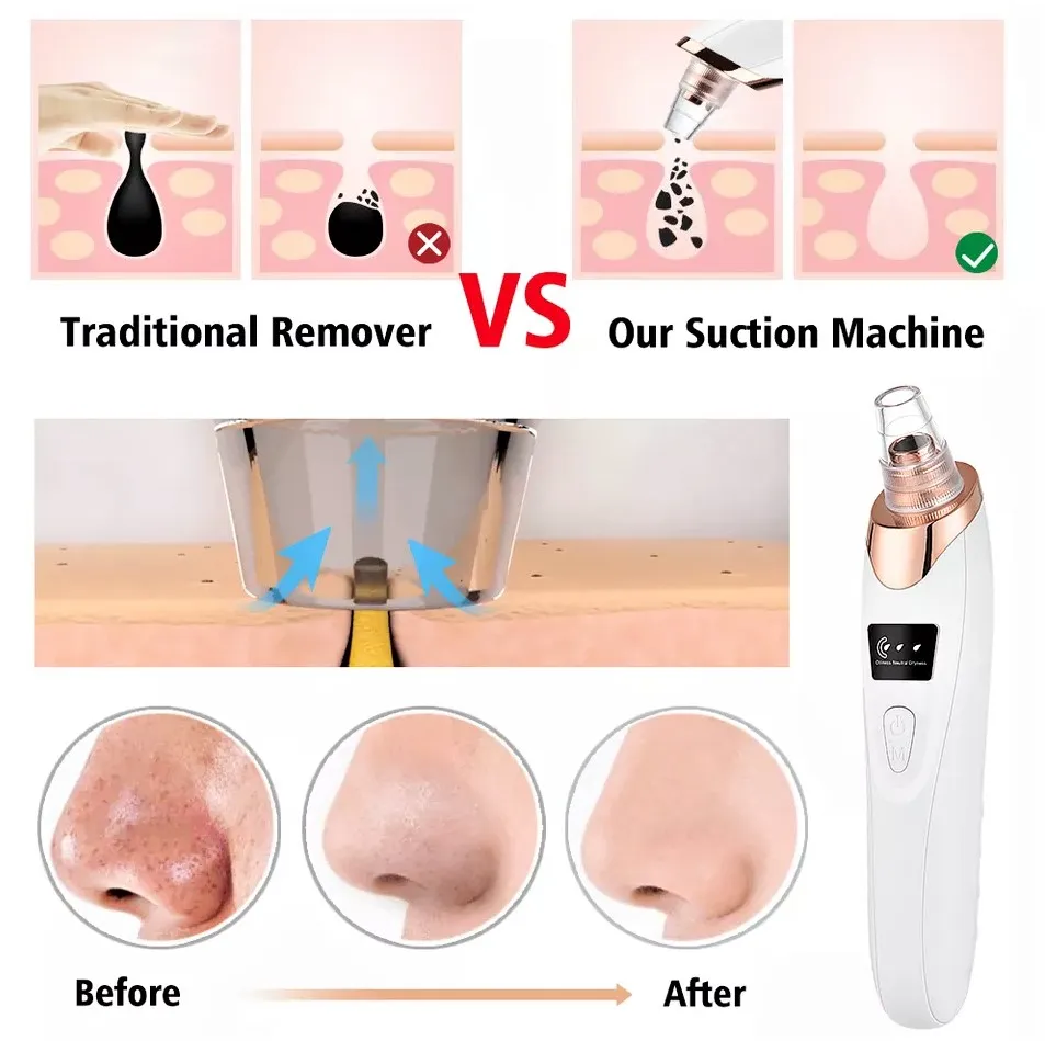 Original Multifunction Blackhead Removal Rechargeable Machine - Image 4